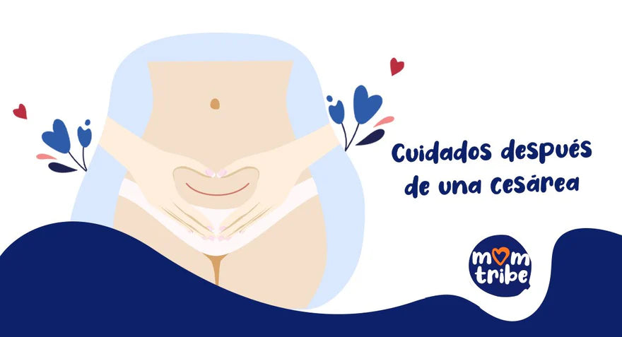 Cuidados después de una cesárea