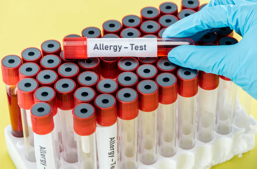 ¿Cómo saber si mi bebé tiene sensibilidad a la fórmula para bebé con leche de vaca?