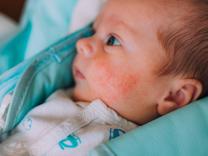 Manchas en la piel del recién nacido: guía de lo normal versus lo preocupante